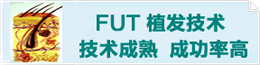 FUT植发